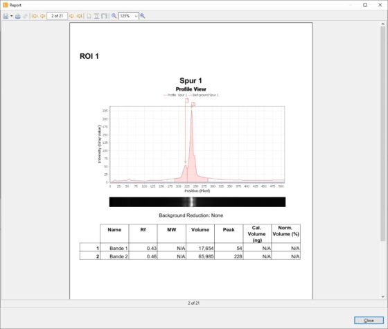 LabImage 1D EPO capture 12 560x475 1