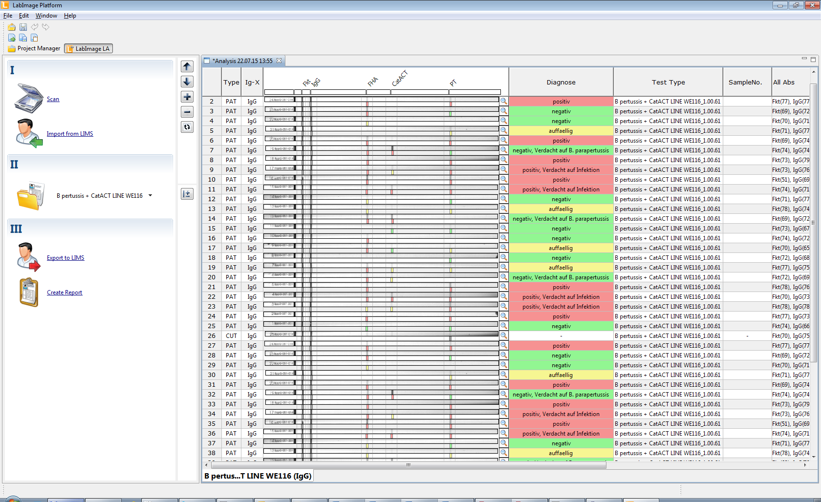 LabImage LA – Linien-Assays und Lateral-Flow-Tests 1 labimage la main